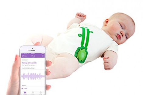 Mimo Smart Baby Monitor 1